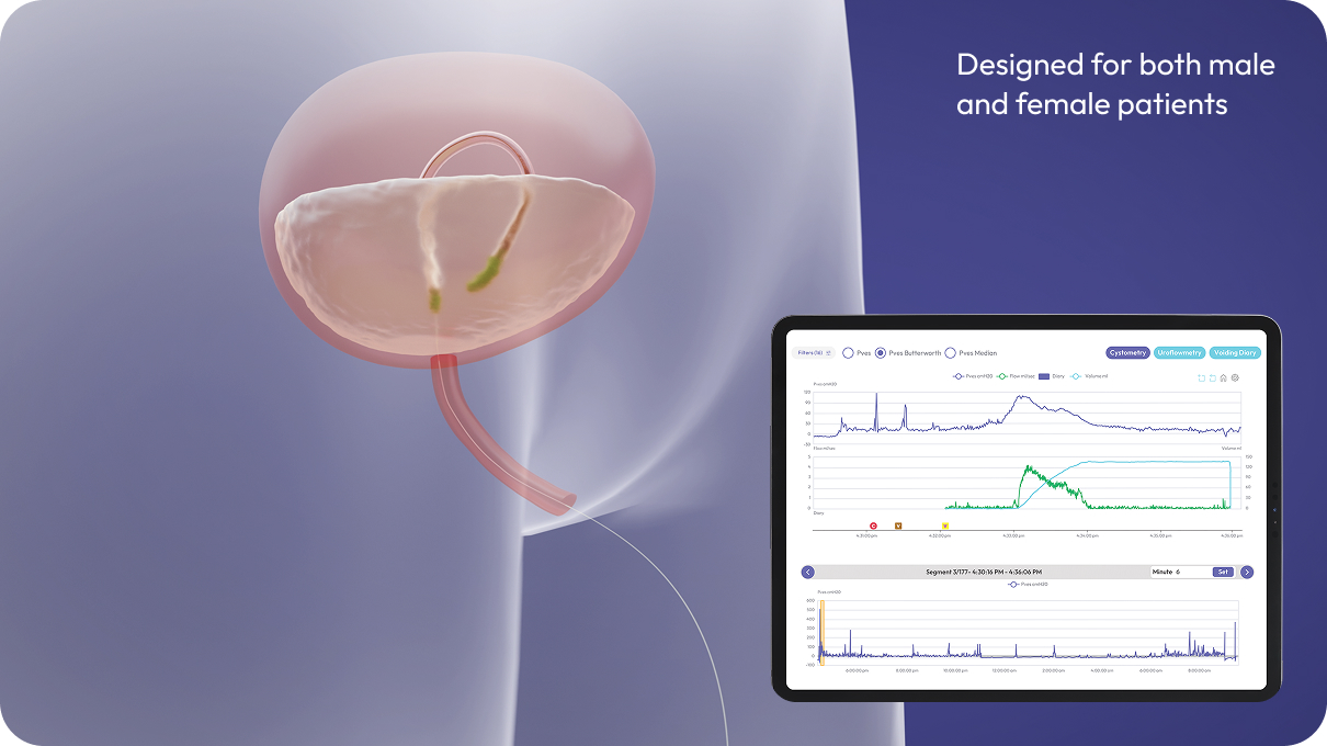 Designed for both male and female patients
